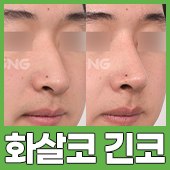 gnghospital media