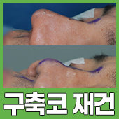 gnghospital media