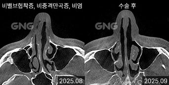 gnghospital media