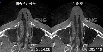 gnghospital media