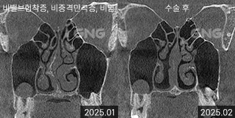 gnghospital media
