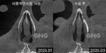 gnghospital media