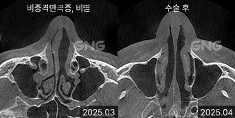 gnghospital media