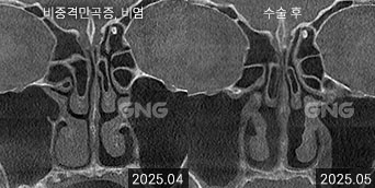 gnghospital media