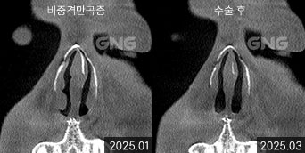 gnghospital media