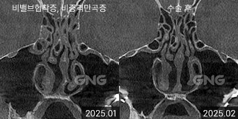 gnghospital media