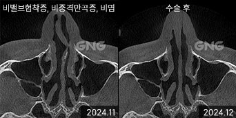 gnghospital media