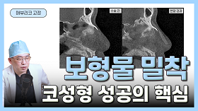 gnghospital media