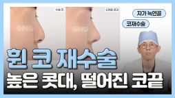 지앤지병원 성형외과 홈페이지 - 지앤지병원