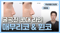 지앤지병원 성형외과 홈페이지 - 지앤지병원