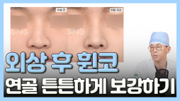 지앤지병원 성형외과 홈페이지 - 지앤지병원