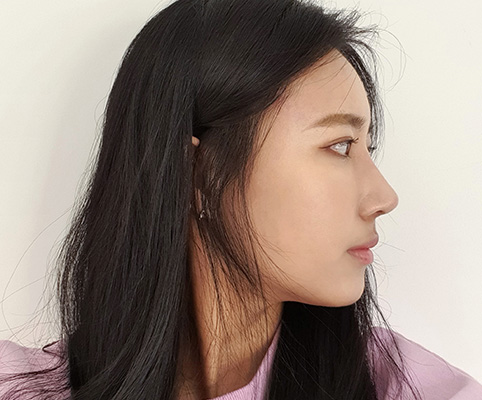 리얼스토리 사진, 지앤지병원 후기 - 지앤지병원