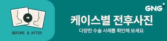 %25EC%25A0%2584%25ED%259B%2584%25EC%2582%25AC%25EC%25A7%2584-%25EB%25B0%25B0%25EB%2584%2588.jpg